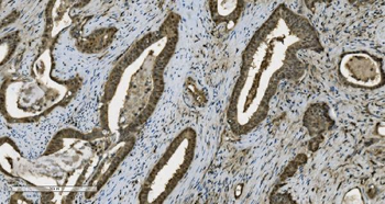 Anti-PARP/PARP1 Antibody (monoclonal, 10E11)