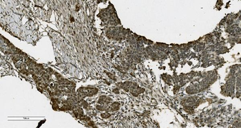 Anti-PARP/PARP1 Antibody (monoclonal, 10E11)