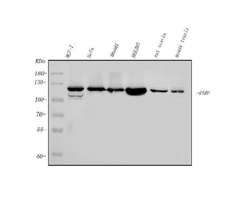 Anti-PARP/PARP1 Antibody (monoclonal, 10E11)
