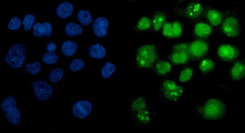 Anti-PARP/PARP1 Antibody (monoclonal, 10G9)