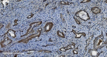 Anti-PARP/PARP1 Antibody (monoclonal, 10G9)