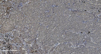 Anti-PARP/PARP1 Antibody (monoclonal, 10G9)