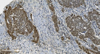 Anti-PARP/PARP1 Antibody (monoclonal, 10G9)