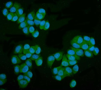 Anti-MPI Antibody (monoclonal, 5G5)