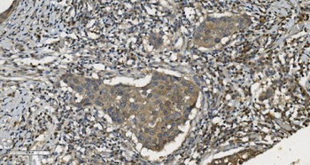 Anti-MPI Antibody (monoclonal, 5G5)