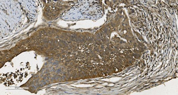 Anti-MPI Antibody (monoclonal, 5G5)