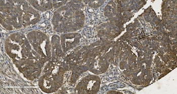 Anti-MPI Antibody (monoclonal, 5G5)