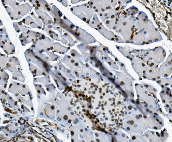 Anti-Transketolase/TKT Antibody (monoclonal, 3E5)