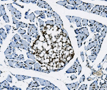 Anti-Transketolase/TKT Antibody (monoclonal, 3E5)