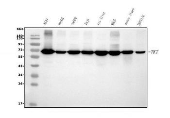 Anti-Transketolase/TKT Antibody (monoclonal, 3E5)
