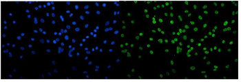 Anti-Transketolase/TKT Antibody (monoclonal, 3E5)