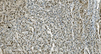 Anti-Transketolase/TKT Antibody (monoclonal, 3E5)