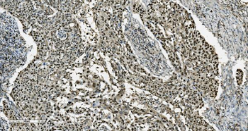 Anti-Transketolase/TKT Antibody (monoclonal, 3E5)