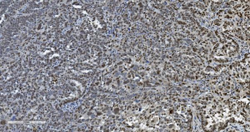 Anti-Transketolase/TKT Antibody (monoclonal, 3E5)