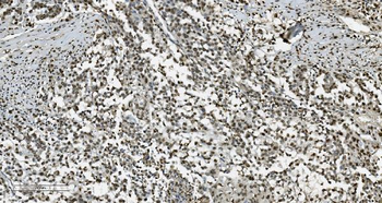Anti-Transketolase/TKT Antibody (monoclonal, 3E5)