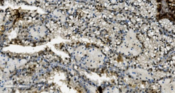 Anti-Transketolase/TKT Antibody (monoclonal, 3E5)