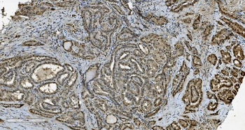 Anti-Transketolase/TKT Antibody (monoclonal, 3E5)