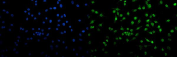 Anti-Transketolase/TKT Antibody (monoclonal, 2I3)