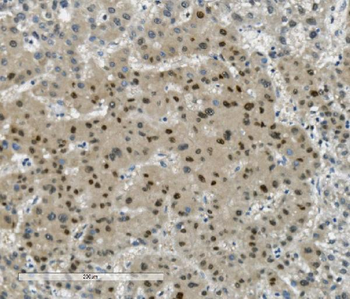 Anti-Transketolase/TKT Antibody (monoclonal, 2I3)