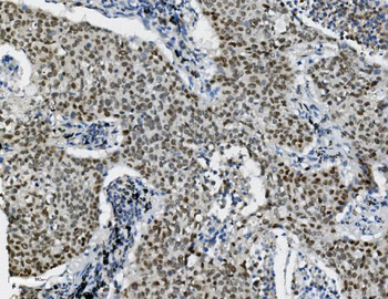 Anti-Transketolase/TKT Antibody (monoclonal, 2I3)