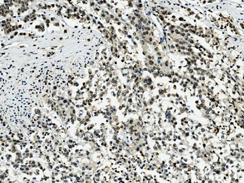 Anti-Transketolase/TKT Antibody (monoclonal, 2I3)