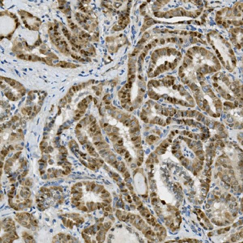 Anti-Transketolase/TKT Antibody (monoclonal, 2I3)