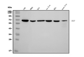 Anti-Transketolase/TKT Antibody (monoclonal, 2I3)