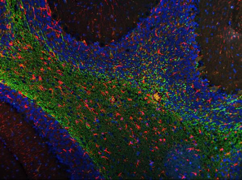 Anti-MAG Antibody (monoclonal, 2G11)