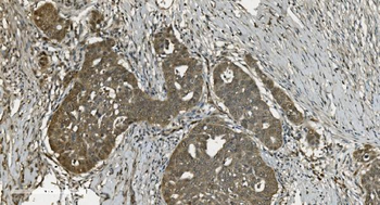 Anti-U2AF65/U2AF2 Antibody (monoclonal, 10F4)