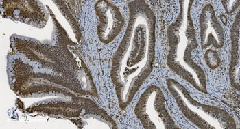 Anti-U2AF65/U2AF2 Antibody (monoclonal, 10F4)