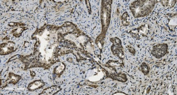Anti-U2AF65/U2AF2 Antibody (monoclonal, 10F4)