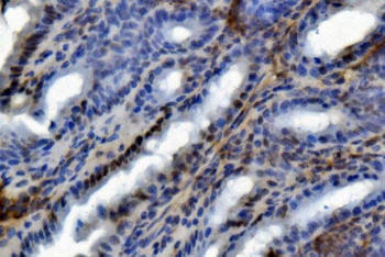 Anti-U2AF65/U2AF2 Antibody (monoclonal, 10F4)