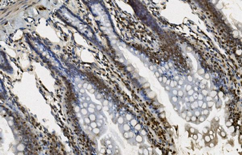 Anti-U2AF65/U2AF2 Antibody (monoclonal, 10F4)