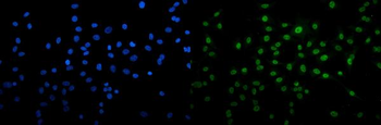 Anti-U2AF65/U2AF2 Antibody (monoclonal, 3G9)