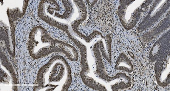 Anti-U2AF65/U2AF2 Antibody (monoclonal, 3G9)