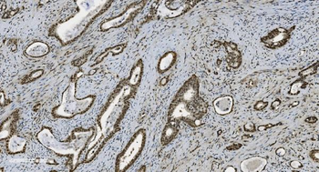 Anti-U2AF65/U2AF2 Antibody (monoclonal, 3G9)