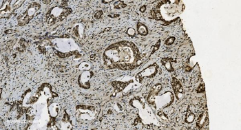 Anti-U2AF65/U2AF2 Antibody (monoclonal, 3G9)