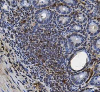 Anti-U2AF65/U2AF2 Antibody (monoclonal, 3G9)