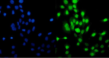 Anti-MCM5 Antibody (monoclonal, 4G10)