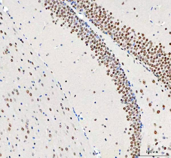 Anti-DDX1 Antibody (monoclonal, 3I10)