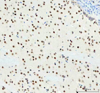 Anti-DDX1 Antibody (monoclonal, 3I10)