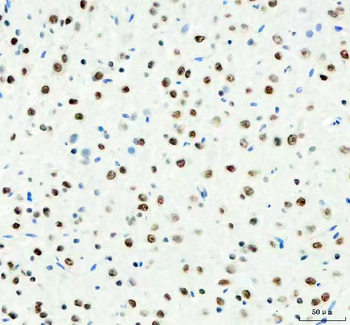 Anti-DDX1 Antibody (monoclonal, 3I10)