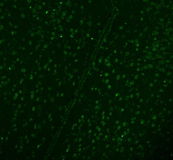 Anti-DDX1 Antibody (monoclonal, 3I10)