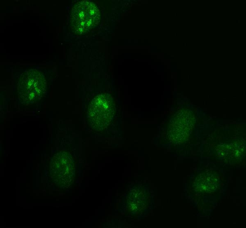 Anti-DDX1 Antibody (monoclonal, 3I10)