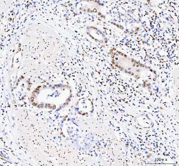 Anti-DDX1 Antibody (monoclonal, 3I10)