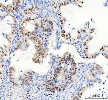 Anti-DDX1 Antibody (monoclonal, 3I10)