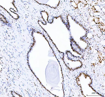 Anti-DDX1 Antibody (monoclonal, 3I10)