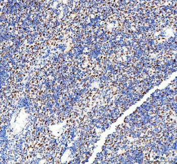 Anti-DDX1 Antibody (monoclonal, 3I10)
