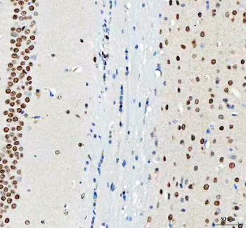 Anti-DDX1 Antibody (monoclonal, 3I10)