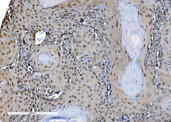 Anti-DDX1 Antibody (monoclonal, 2D4)